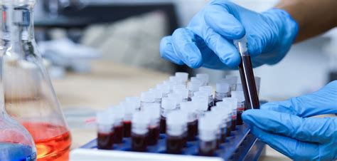 Researchers find treatment options for patients whose blood cancer relapses after CAR-T