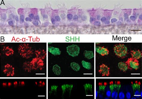 Motile cilia of human airway epithelia contain hedgehog signaling ...