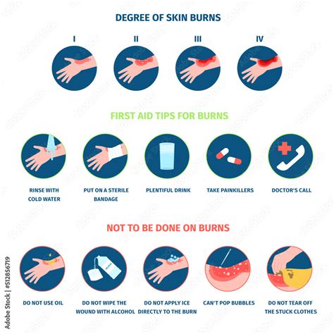 Skin burn stages infographics and treatment. Thermal burns types, burning hands and medical care ...