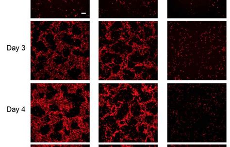 Stem cells used to make insulin-producing pancreatic beta cells - Biomat | The Biomaterials Network