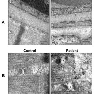 Electron microscopy analysis of skeletal muscle fibers (M) from the... | Download Scientific Diagram