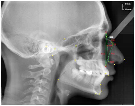 Diagnostics | Free Full-Text | Investigation of the Relationship ...