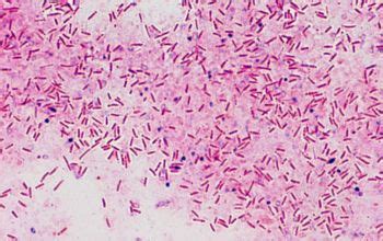 Clostridium septicum