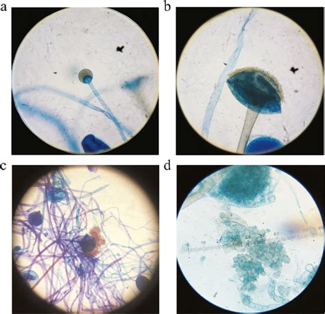 Rhizopus Under Compound Microscope