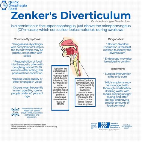 Zenkers Diverticulum Treatment