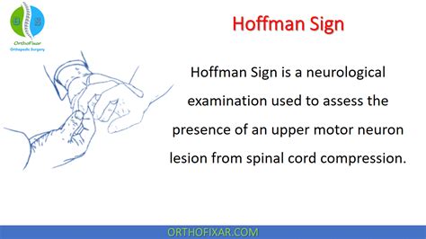 Hoffman Sign For Upper Motor Neuron | OrthoFixar 2024