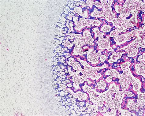 File:Bone histology 015.jpg - Embryology