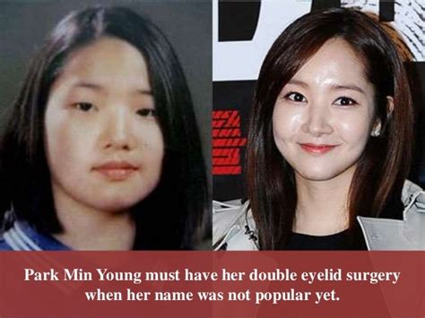 Park min young plastic surgery