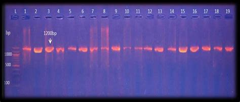 Burning Bright: A Brief History Of Ethidium Bromide DNA, 55% OFF