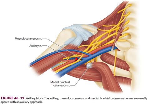 Axillary Nerve Block