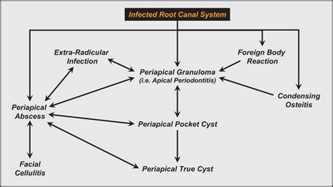 Pulp, Root Canal, and Periradicular Conditions | Pocket Dentistry