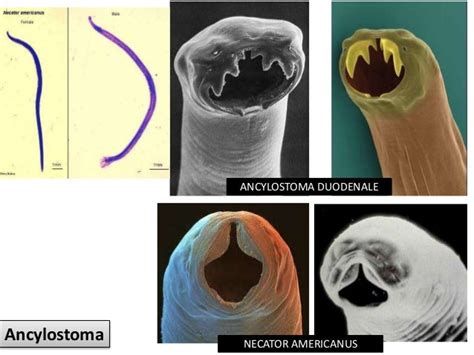 Atlas de parasitología