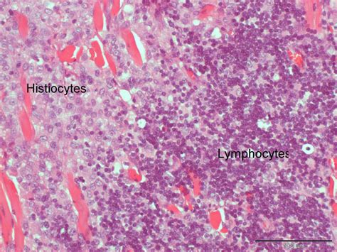 A benign cutaneous histiocytoma in a pug | Case Study | Cytopath