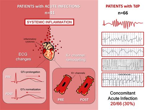 Cardiac Arrest Risk During Acute Infections | Circulation: Arrhythmia and Electrophysiology