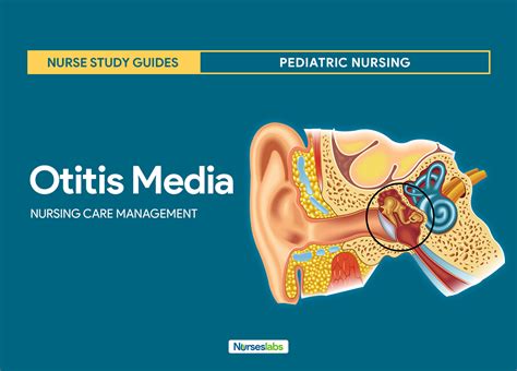 Otitis Media Nursing Care Planning and Management: Study Guide