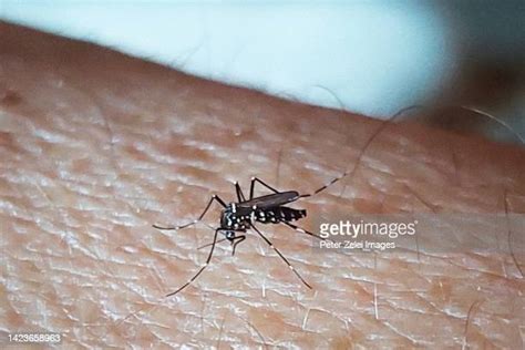 57 Asian Tiger Mosquito Bite Stock Photos, High-Res Pictures, and ...