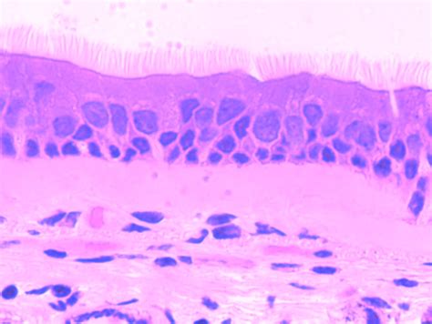 Pseudostratified