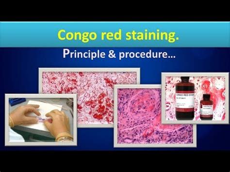 Congo red staining method,(Clear overview,Principle,procedure,Uses) - YouTube