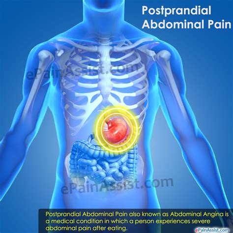 Postprandial Abdominal Pain|Causes| Symptoms|Treatment