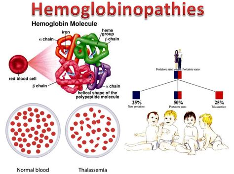 Hemoglobinopathy Market is Touching New Development Level |Nexcelom Bioscience, Nihon Kohden ...