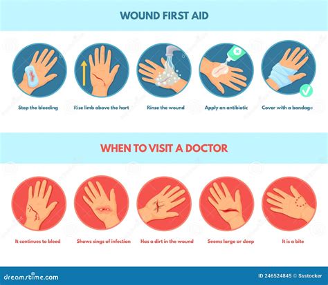 Aid Skin Wound. First Aids Stop Bleeding, Infographic Types Emergency ...