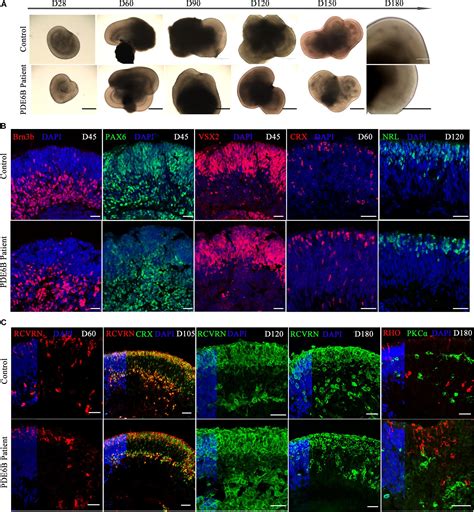 Frontiers | Patient-Specific Retinal Organoids Recapitulate Disease ...