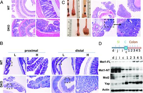 Mst1null/Mst2ff/villin-Cre (DKO) mice exhibit loss of goblet cells,... | Download Scientific Diagram