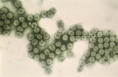 [Figure, Polyomavirus, electron microscopy. Icosahedral virions ...