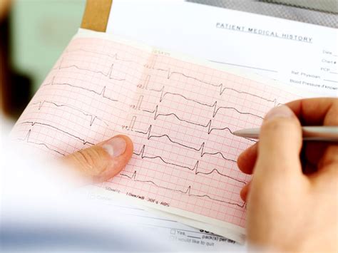 Stress Echocardiography: Purpose, Procedure, and Results