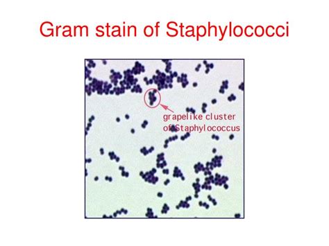 PPT - Practical Medical Microbiology PHT313 PowerPoint Presentation - ID:7027627