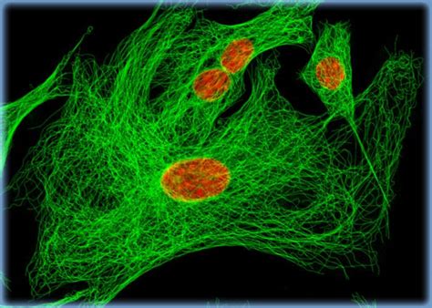 Microtubules Immunofluorescently Visualized in Mongolian Gerbil Lung ...