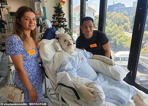 Inspirational White Island survivor shares harrowing photo taken moments after waking from a ...