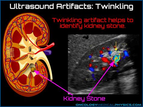 Ultrasound | Oncology Medical Physics