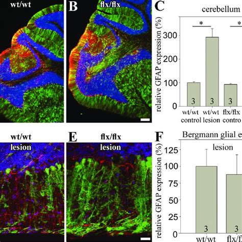 Cerebellar stab wound lesions induce upregulation of GFAP independent... | Download Scientific ...