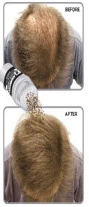 Hair Building Fibers - Thickening Powder For Thinning Australia