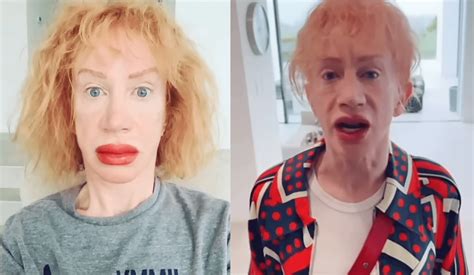 Yikes: Kathy Griffin Shocks Fans with Red, Swollen, Lips After ...