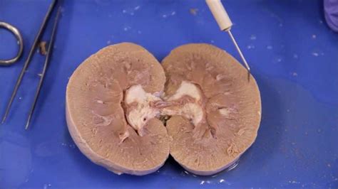 BIO202 L Sheep Kidney Dissection | Basic anatomy and physiology ...