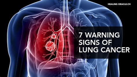 What Is Signs Of Lung Cancer : Lung cancer symptoms and prevention ...