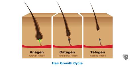 Telogen Effluvium – a common form of hair loss - AHS UAE