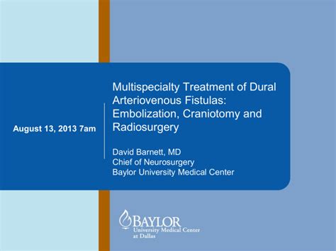 Multispecialty Treatment of Dural Arteriovenous Fistulas