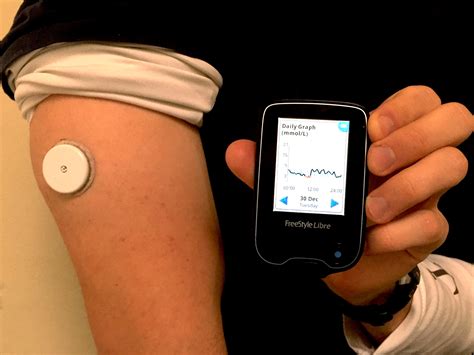 Abbott’s FreeStyle Libre – Transforming Glucose Monitoring Through Utter Simplicity ...