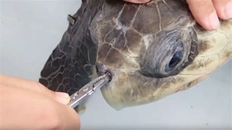 Plastic straw removed from turtle's nose by marine biologists