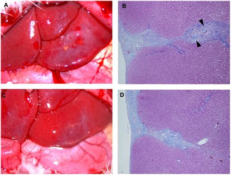 (A) Healed liver lacerations in the 1.5% (w/v) SPG-178 group. (B) A... | Download Scientific Diagram