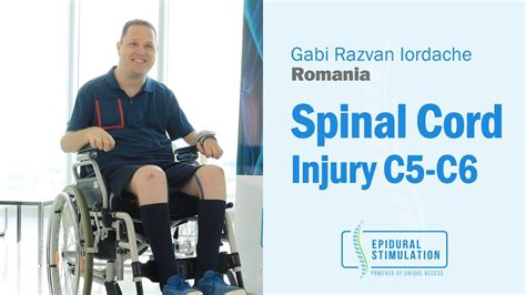 C5-C6 Spinal Cord Injury Patient Gabi from Romania Makes Great Progress After Epidural ...