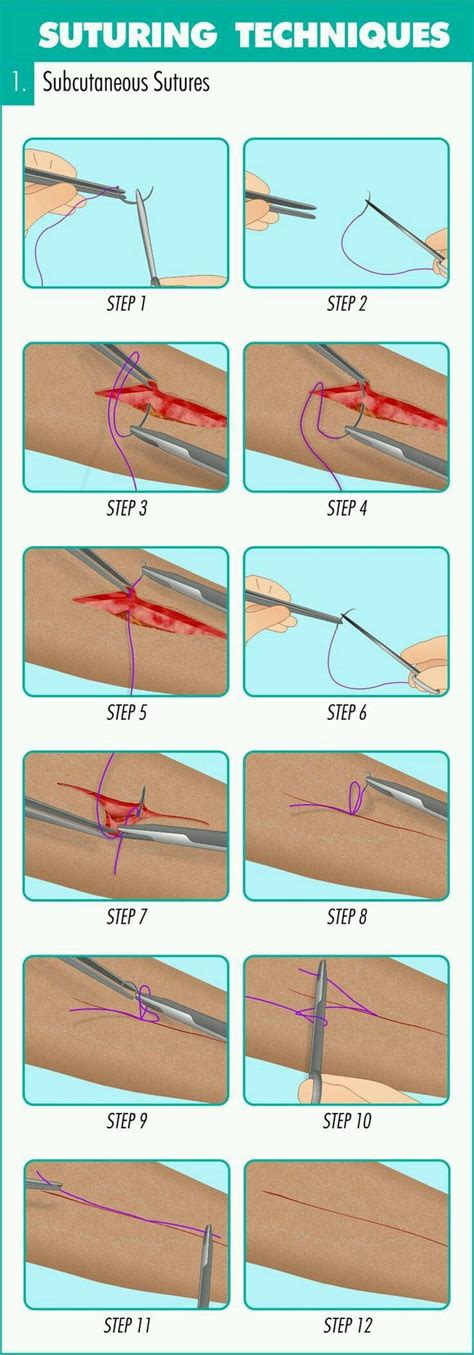 11 best Suture methods images on Pinterest | Anatomy, Survival skills and Survival stuff