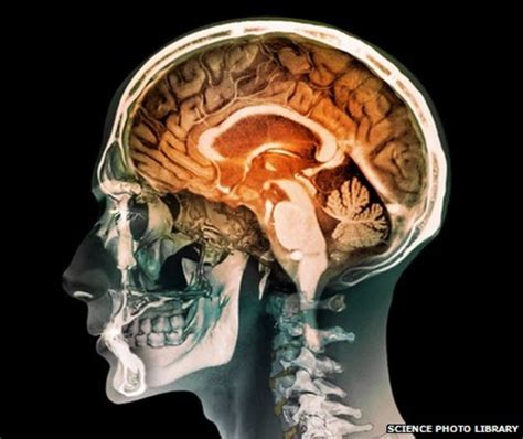 Is your brain male or female? - BBC News