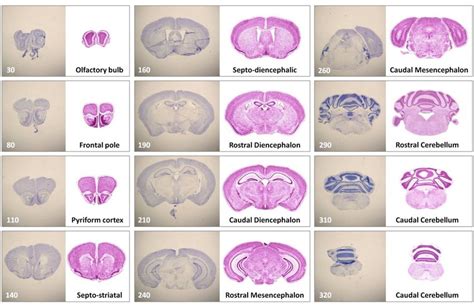 2 Representative mouse brain reference chart. For each cryo-preserved... | Download Scientific ...