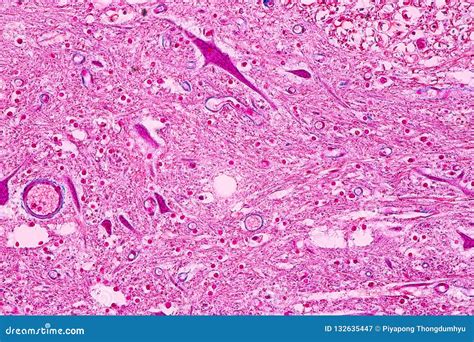 Cross Section of the Cerebellum and Nerve Human Under the Microscope for Education. Stock Image ...