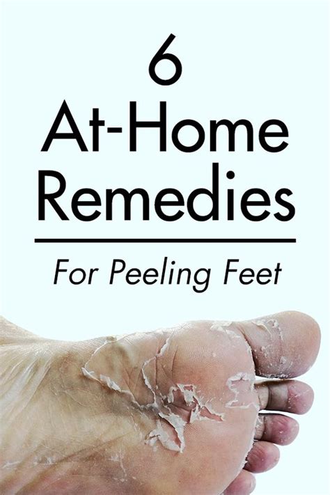 How to Get Rid of Calluses: 6 At-Home Methods - Home Remedies