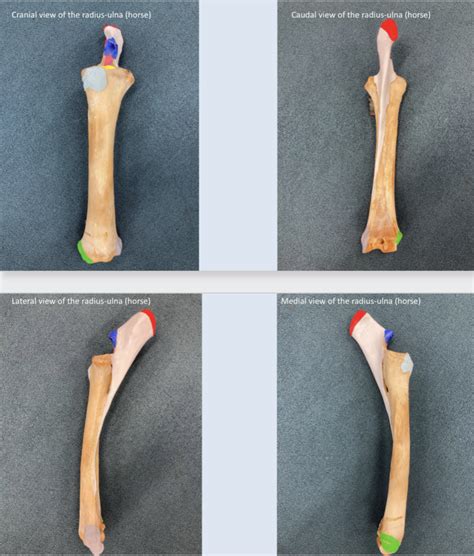 Radius/Ulna Osteology Diagram | Quizlet